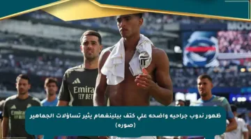 ظهور ندوب جراحية واضحة على كتف بيلينغهام يثير تساؤلات الجماهير (صورة)